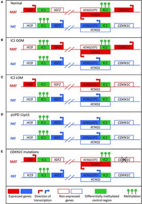 Diagnosis and Management of Beckwith-Wiedemann Syndrome